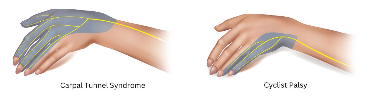 numb hands cycling